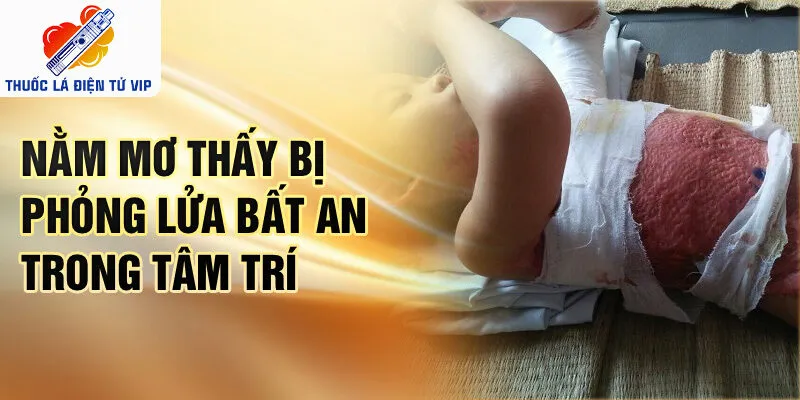 Nằm mơ thấy bị phỏng lửa bất an trong tâm trí