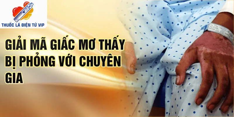 Giải mã giấc mơ thấy bị phỏng với chuyên gia